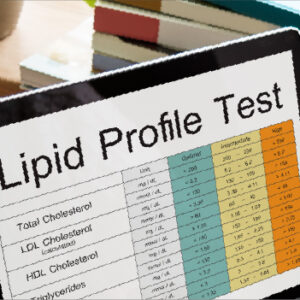 lipid profile test