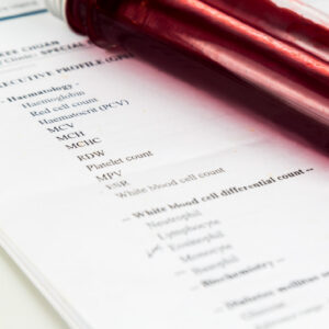 Erythrocyte Sedimentation Rate (ESR)