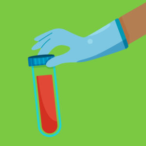 Cervical Liquid Based Cytology