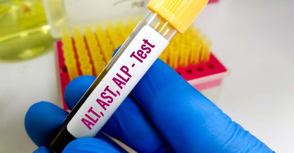 liver function test