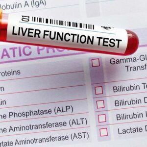 liver function test