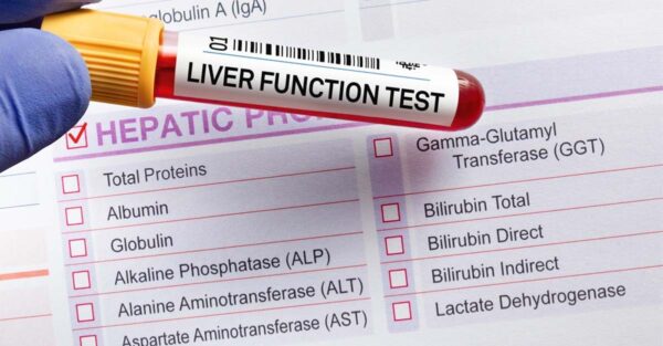 What Is Liver Function Test And Its Importance To Health – Medbury ...