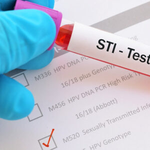 Sexually Transmitted Disease